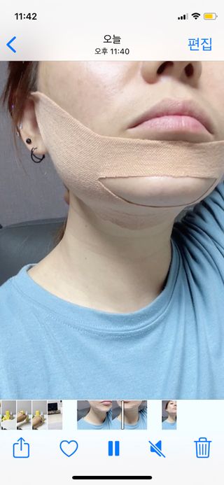 아이디플라코스메틱 아이디 페이스핏 마이너스 밴드 v2 — 5점을 준 리뷰어가 2021년 5월 올린 사용 사진