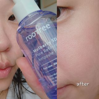 루트리 오디베리 5중 모공 리파이닝 앰플 — 5점을 준 리뷰어가 2023년 8월 올린 사용 사진