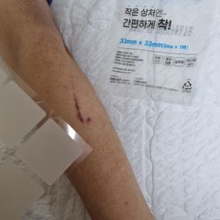 [큐어반H 커팅] 간편하게 떼서 쓰는 자외선차단 습윤밴드 (1팩/30매입) — 4.5점을 준 리뷰어가 2022년 11월 올린 사용 사진