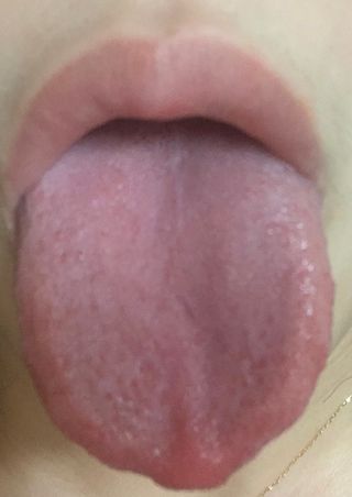 크리오 클리어스 혀백태제거 구취관리 혀클리너 — 5점을 준 리뷰어가 2021년 3월 올린 사용 사진
