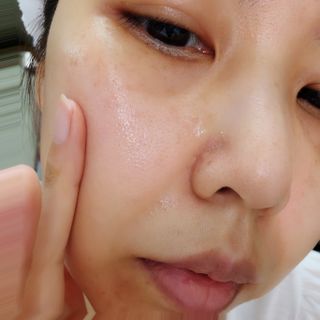 루트리 오디베리 5중 모공 리파이닝 앰플 — 5점을 준 리뷰어가 2023년 6월 올린 사용 사진