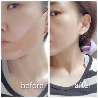 아이디플라코스메틱 아이디 페이스핏 마이너스 밴드 v2 — 5점을 준 리뷰어가 2021년 5월 올린 사용 사진