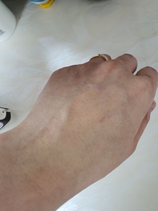 아이디플라코스메틱 아이디 브이로직 마이너스 필링 토너 110ml — 4점을 준 리뷰어가 2022년 1월 올린 사용 사진