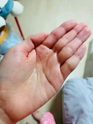 셀바이져 지우개 미스트 피부 보호 입주변 트러블 진정 케어 아기 안개분사 미스트 — 5점을 준 리뷰어가 2021년 3월 올린 사용 사진