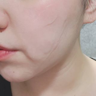 리더스코스메틱 리더스 퍼스트 샷 액티브 에센스 에이지 컨트롤 — 5점을 준 리뷰어가 2021년 12월 올린 사용 사진