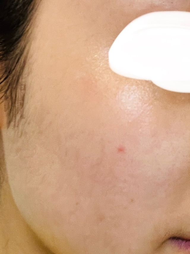 산다화 비타민c 화이트닝 에센스 30ml 리뷰 사진