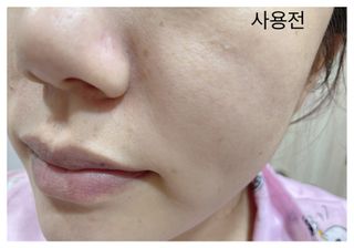 산수시 데포 세럼 수분 물광 비타민 에센스 50ml 기초화장품 — 5점을 준 리뷰어가 2021년 8월 올린 사용 사진