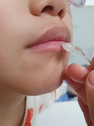 [후르디아] 유아부터 어른까지, 안심 아보카도 립밤 듀오 세트 — 5점을 준 리뷰어가 2024년 1월 올린 사용 사진