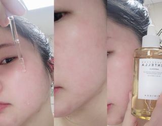 [스킨1004] 마다가스카르 센텔라 앰플 100ml — 5점을 준 리뷰어가 2024년 5월 올린 사용 사진
