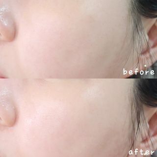 메이쿱 로우 소스 더 비건 에센스 100ml — 5점을 준 리뷰어가 2022년 4월 올린 사용 사진