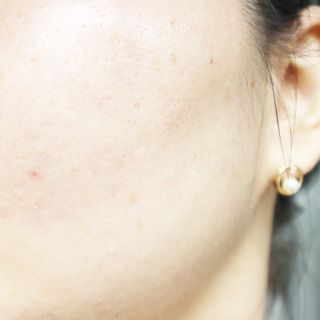 [ 유니자르 ] 미백의 끝판왕 = 브라이트닝99 + 나이아신아마이드100 — 5점을 준 리뷰어가 2022년 1월 올린 사용 사진