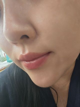 MF[더메디코템] 스피큘 DCA V리프팅 크림 — 4점을 준 리뷰어가 2024년 4월 올린 사용 사진