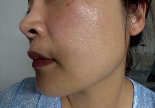 닥터초이스 [쿠팡 구매평] 황해쑥 시카엑소좀 카밍 앰플 PDRN  나이아신 IGF FGF AHA BHA 트러블케어 특허, 1개, 30g — 5점을 준 리뷰어가 2025년 6월 올린 사용 사진