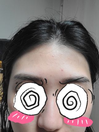 히루스카 포스트아크네 클리어 — 4점을 준 리뷰어가 2021년 2월 올린 사용 사진
