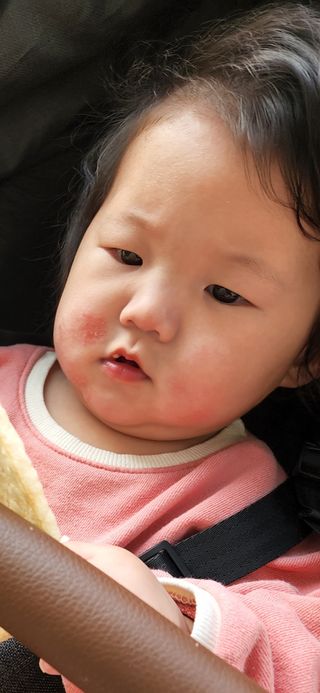 젠바이오 코스메틱스 젠바이오수딩크림]   가려운 피부 & 아토피 원픽 크림 — 5점을 준 리뷰어가 2022년 9월 올린 사용 사진