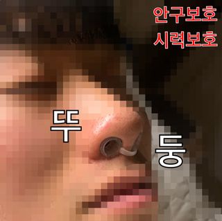 풋테크 코가 뻥 코스마일 1개입 — 4점을 준 리뷰어가 2021년 1월 올린 사용 사진