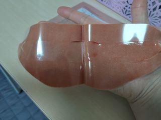 아이디플라코스메틱 아이디 페이스핏 마이너스 밴드 v2 — 3점을 준 리뷰어가 2021년 4월 올린 사용 사진