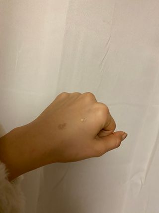 히루스카 포스트아크네 클리어 — 5점을 준 리뷰어가 2021년 1월 올린 사용 사진