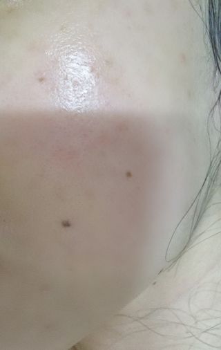 선경코스메디 [NCOSTI] 엔코스티 EGF 펩타이드 리페어 마스크팩 10매입 — 5점을 준 리뷰어가 2022년 3월 올린 사용 사진