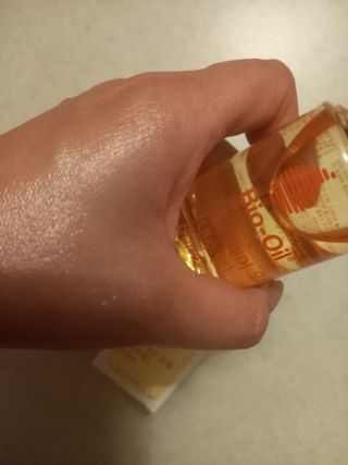 바이오오일 [바이오-오일] 스킨케어 오일 내추럴 60ml — 5점을 준 리뷰어가 2021년 11월 올린 사용 사진