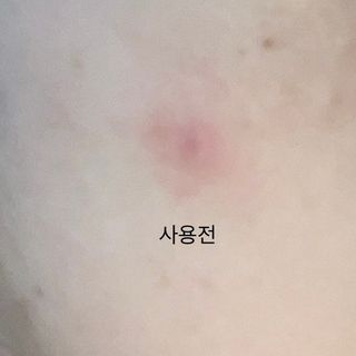 체르엠 그린 케비어 더블워터 마스크팩 5매입  2팩 — 5점을 준 리뷰어가 2021년 11월 올린 사용 사진
