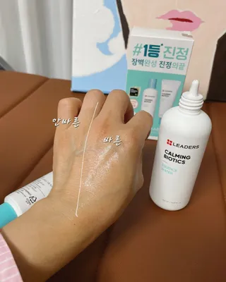 리더스코스메틱 리더스 카밍 바이오틱스 #1등 진정 기획세트 [에센스 워터150ml + 크림 마스크80ml] — 5점을 준 리뷰어가 2022년 9월 올린 사용 사진