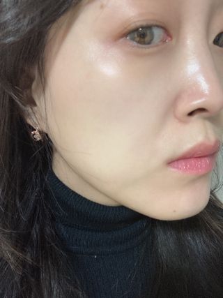 [메디팜] 대용량 바이옴 미백 비타민 앰플 — 4점을 준 리뷰어가 2022년 2월 올린 사용 사진