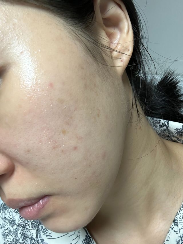 SARAH Helix + SARAH VC alpha 리뷰 사진