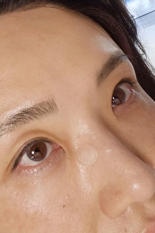 올리브영 엘라밴드 하이드로 도트 스팟패치 12mm, 티트리 — 5점을 준 리뷰어가 2022년 9월 올린 사용 사진