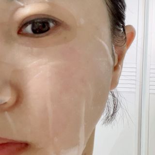 세뚜아(Cettua) 세뚜아 스팟 클리어 듀얼 패치 Cettua Spot Clear Dual Patch — 5점을 준 리뷰어가 2023년 7월 올린 사용 사진