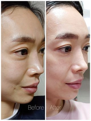 선경코스메디 [NCOSTI] 엔코스티 EGF 펩타이드 리페어 마스크팩 10매입 — 5점을 준 리뷰어가 2022년 3월 올린 사용 사진