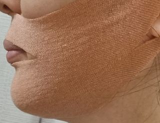 아이디플라코스메틱 아이디 페이스핏 마이너스 밴드 v2 — 5점을 준 리뷰어가 2021년 10월 올린 사용 사진