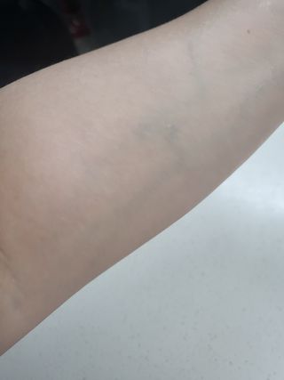 아이디플라코스메틱 아이디 브이로직 마이너스 필링 토너 110ml — 5점을 준 리뷰어가 2022년 5월 올린 사용 사진