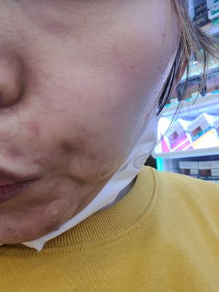 오투에니원 화이트 스완 갈락토미세스 비타민 C 필링 패드 60매 — 5점을 준 리뷰어가 2022년 12월 올린 사용 사진