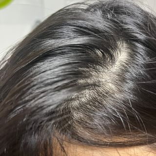 나노힐 아미노 샴푸 300ml — 5점을 준 리뷰어가 2023년 4월 올린 사용 사진