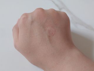 [큐어반H 스팟] 자외선 99프로 차단되는 스틱타입 스팟밴드(1팩 / 66매입) — 5점을 준 리뷰어가 2022년 11월 올린 사용 사진