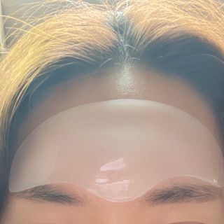 아이디플라코스메틱 아이디 페이스핏 플러스 패치 v2 — 4점을 준 리뷰어가 2021년 4월 올린 사용 사진