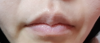 틱톡 [후르디아] 튼입술해결템 올리브영 블루베리 하이드레이팅 허니 립밤 — 4점을 준 리뷰어가 2024년 3월 올린 사용 사진