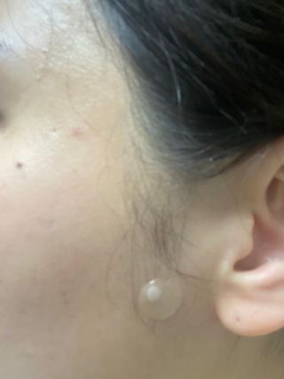세뚜아(Cettua) 세뚜아 스팟 클리어 듀얼 패치 Cettua Spot Clear Dual Patch — 5점을 준 리뷰어가 2023년 6월 올린 사용 사진