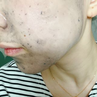 프롬노시베 차콜 소르베 필링 앤 클렌징 밤 — 5점을 준 리뷰어가 2022년 2월 올린 사용 사진