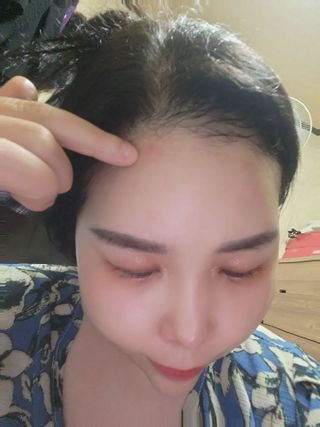 네오메딕스 뷰티 [네오메딕스] 바노바기 피포뮬러 — 5점을 준 리뷰어가 2024년 10월 올린 사용 사진