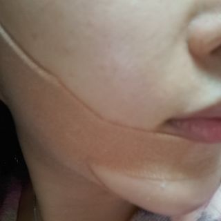 아이디플라코스메틱 아이디 페이스핏 마이너스 밴드 v2 — 4점을 준 리뷰어가 2021년 4월 올린 사용 사진