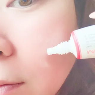 작심연구소 바르는 피부과 레이저 메디스팟크림 플러스 — 5점을 준 리뷰어가 2022년 6월 올린 사용 사진