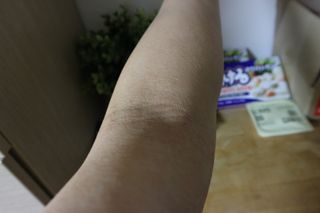 젠바이오 코스메틱스 젠바이오수딩크림]   가려운 피부 & 아토피 원픽 크림 — 5점을 준 리뷰어가 2022년 10월 올린 사용 사진