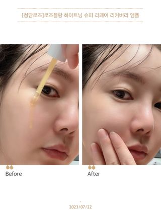 청담로즈 로즈블랑 화이트닝 슈퍼 리페어 리커버리 앰플 — 5점을 준 리뷰어가 2023년 7월 올린 사용 사진
