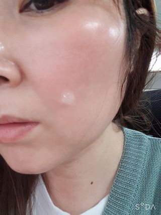 레드투래드 센서티브 어메이징 앰플 30ml — 5점을 준 리뷰어가 2021년 8월 올린 사용 사진