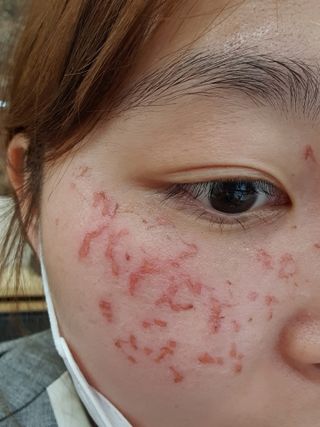 브에노 스킨셀 더마 앰플 — 5점을 준 리뷰어가 2021년 6월 올린 사용 사진