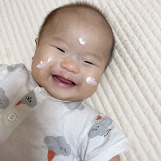 젠바이오 코스메틱스 젠바이오수딩크림]   가려운 피부 & 아토피 원픽 크림 — 5점을 준 리뷰어가 2022년 9월 올린 사용 사진