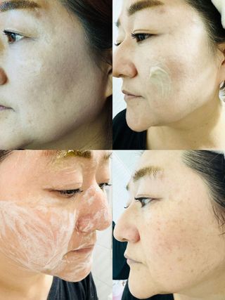 스킨1004 [SKIN1004] 마다가스카르 센텔라 앰플 폼 125ml — 5점을 준 리뷰어가 2024년 8월 올린 사용 사진