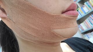 아이디플라코스메틱 아이디 페이스핏 마이너스 밴드 v2 — 5점을 준 리뷰어가 2021년 4월 올린 사용 사진